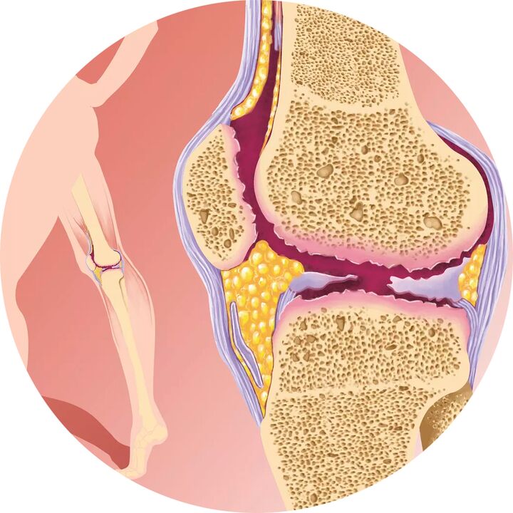 Хондротен - Подпомага подвижността на ставите