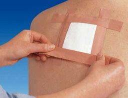 Използване на терапевтичен пластир за болки в гърба